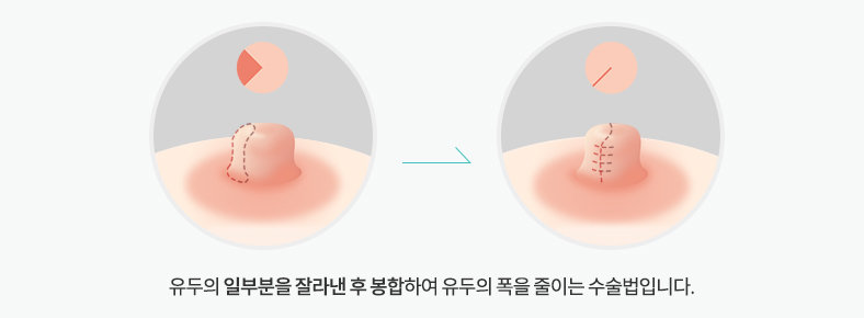 폭이넓은경우