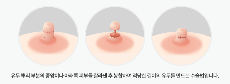 길이가 긴 경우