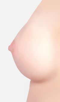 유두모양