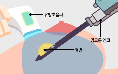 유방상세이미지