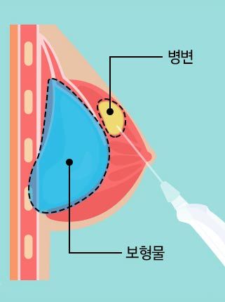 질문이미지
